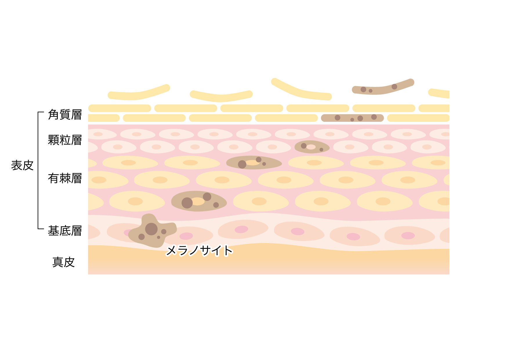 �^�[���I�[�o�[